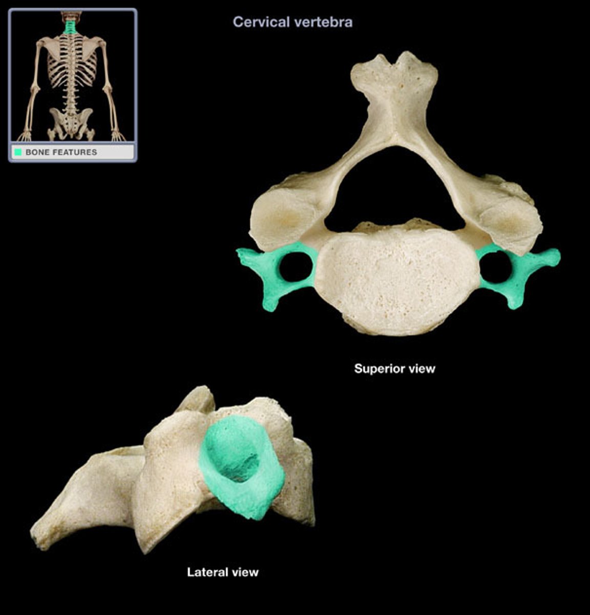<p>(name of the vertebra part)</p>