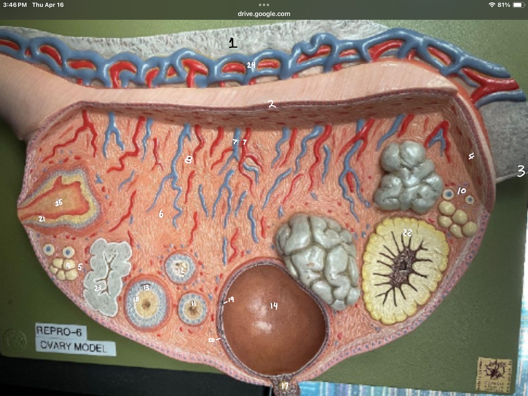 <p>Identify #14 before ovulation</p>