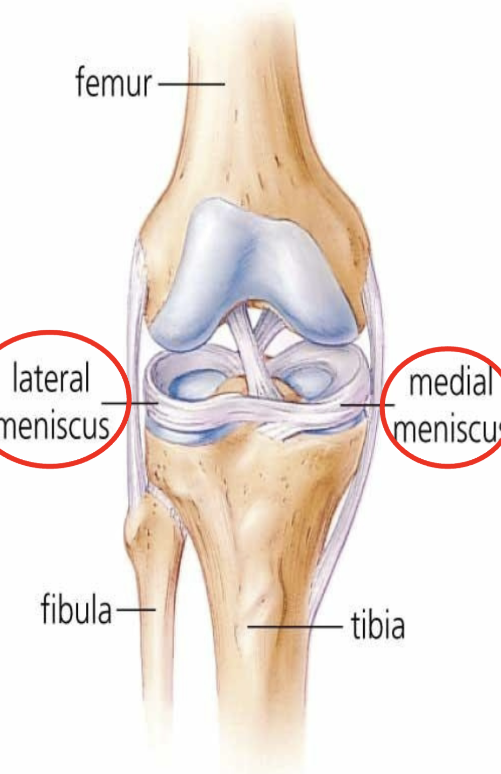 <p></p><p>The joint cavity contains two C-shaped cartilages called the <strong>lateral and medial menisci</strong> joined by a transverse ligament</p><p>⢠The <strong>menisci</strong> absorb the</p><p>shock of the body weight</p>
