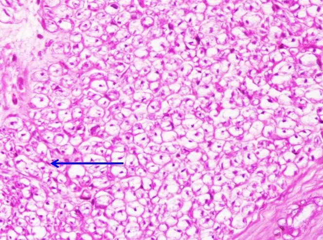 <p>Tế bào gì ?</p>