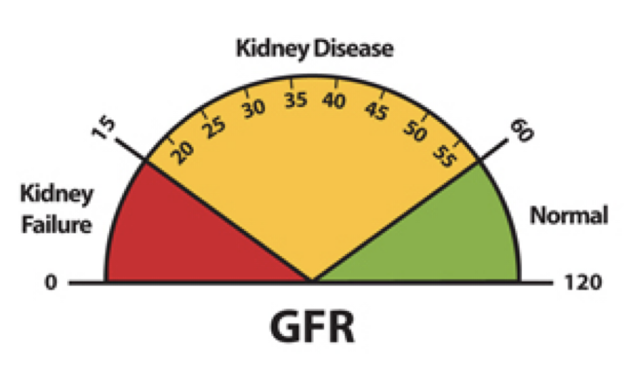<p><strong>renal disorders</strong></p><p>-<u>chronic renal disease</u></p><p>→ GFR < ____</p><p>→ ____ build up in blood</p><p>-<u>renal failure</u></p><p>→ GFR < ___</p><p>-<u>chronic renal failure</u></p><p>→ _____</p><p>→ progresses in stages</p><p>-<u>acute renal failure</u></p><p>→ _____</p><p>→ cased by hypoxia, physical trauma</p><p>-requires transplant or dialysis</p>