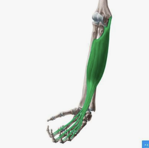 <p>Which muscle is this?</p>