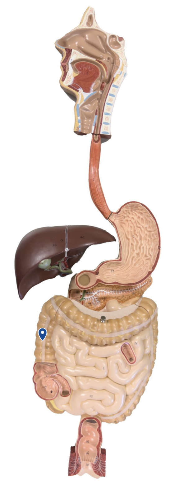 <p>Name this segment of the large intestine.</p>