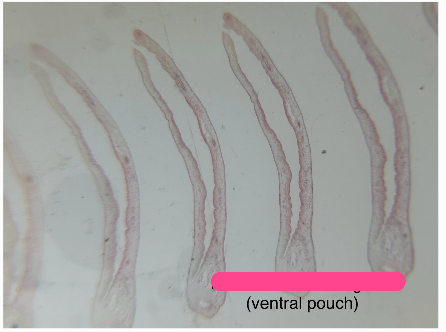 <p>Identification:</p><p>Common name:</p><p>Organ loc:</p><p>Intermediate Host:</p><p>Definitive Host:</p><p>Family:</p>