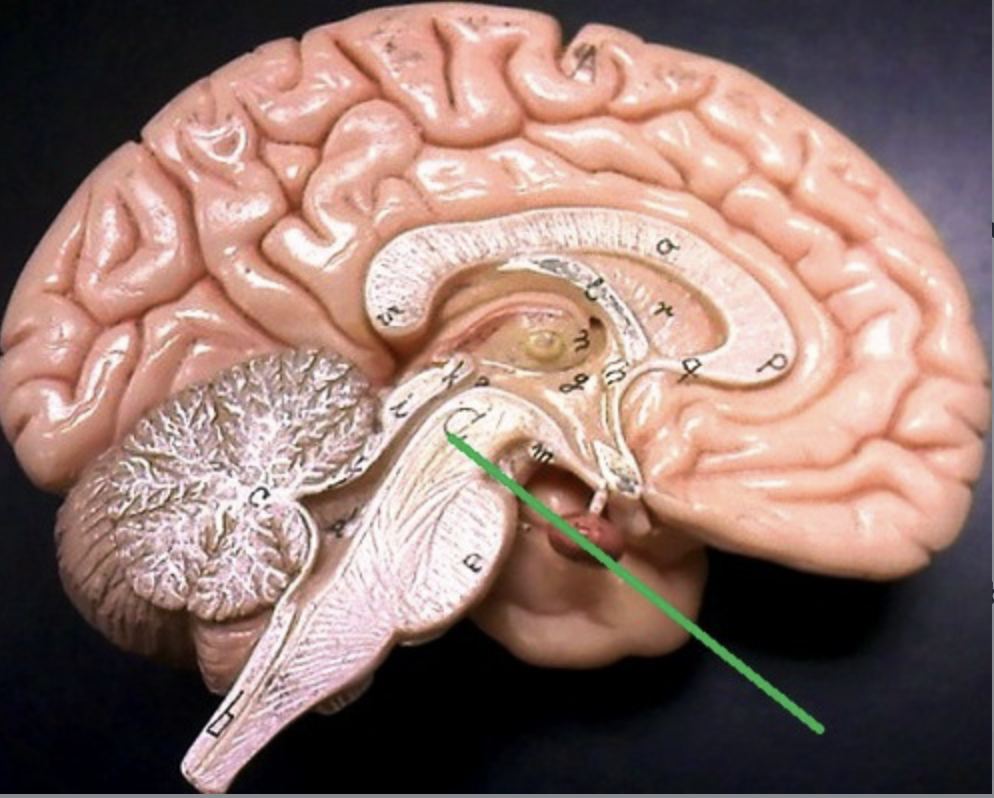 <p>axons connecting cerebellum and pons</p>