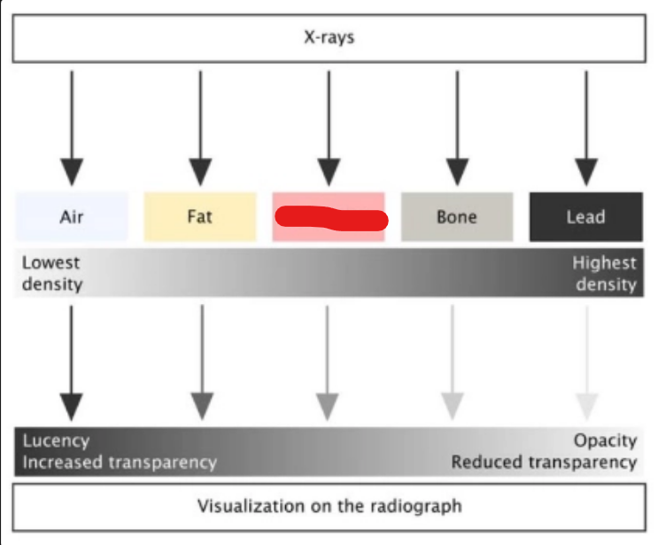 <p>what is it (Intro to Diagnostic Imaging)</p>