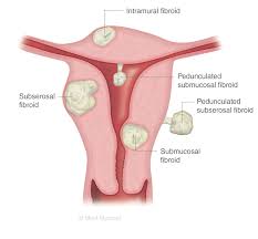 <p><span style="color: rgb(0, 0, 0);"><strong>Latent </strong></span></p>