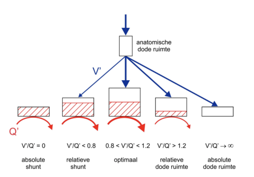 <p>diffusie-evenwicht bij lage V/Q verhouding gaat omlaag, omdat lage V/Q verhouding minder ventilatie betekent = geeft lagere P<sub>A</sub>O<sub>2</sub></p>