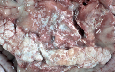 <p><strong>Sätt rätt diagnos på den förändring som ses i bilderna genom att dra rätt ruta till platsen bredvid bilden. Endast en</strong></p><p class="p1"><strong>diagnos per bild. (1.5p)</strong></p>