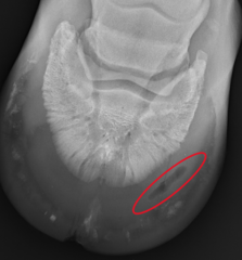<p>Abscess</p>