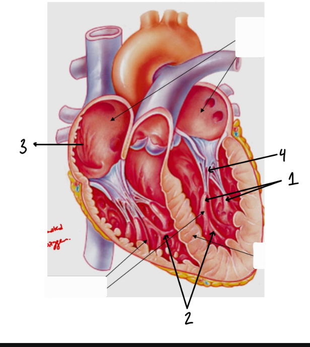 <p>Chordae Tendoneae</p>