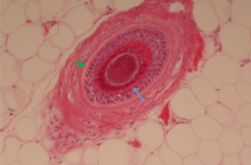 <p>What is this and what are the arrows pointing to?</p>