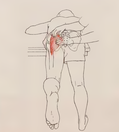 <p>Extension of the hip from a flexed position (knee is in the donkey position)</p>