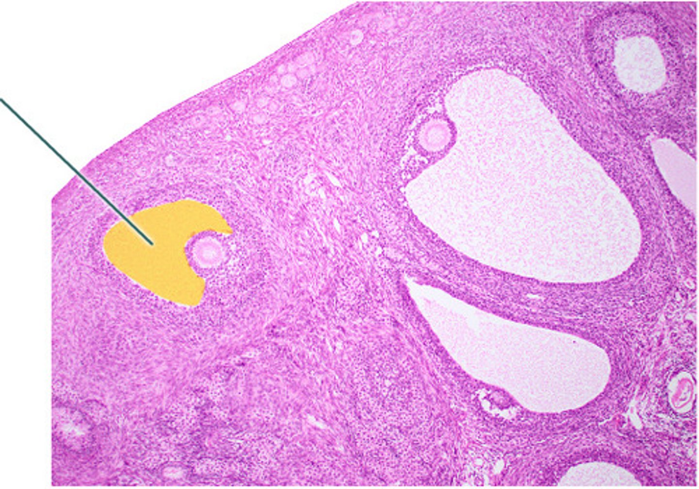<p>-large cavity between layers of granulosa cells</p><p>-contains follicular fluid</p>
