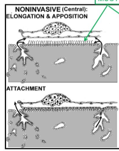<p>What type of implantation is this?</p>