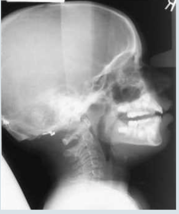 <p>What is a cephalometric exposure?</p>