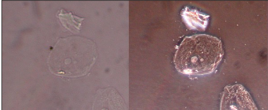 <ul><li><p>makes dense areas more bright</p></li><li><p>reveals many structures without need for staining</p></li><li><p>thus can be performed on unstained (i.e. living) cells</p></li><li><p>can be used for cell culture research</p></li><li><p>appear as bright and dark areas</p></li></ul><p></p>