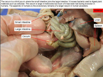 <p>under the large intestine/colon. connects the small intestine to the colon.</p>