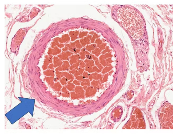 <p>Identify the vessel</p>