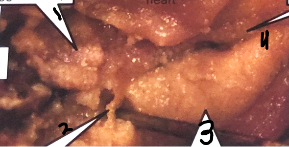 <p>point 2 on this crayfish </p>