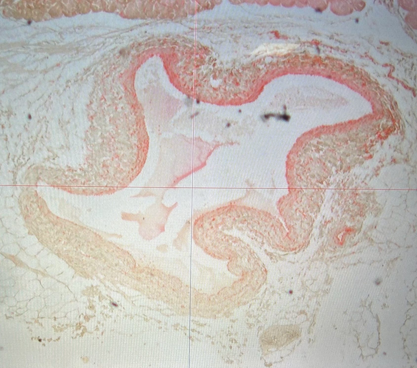 <ul><li><p>tunica externa (adventitia)</p></li><li><p>tunica media</p></li><li><p>tunica intima</p></li><li><p>lumen</p></li></ul><p></p>