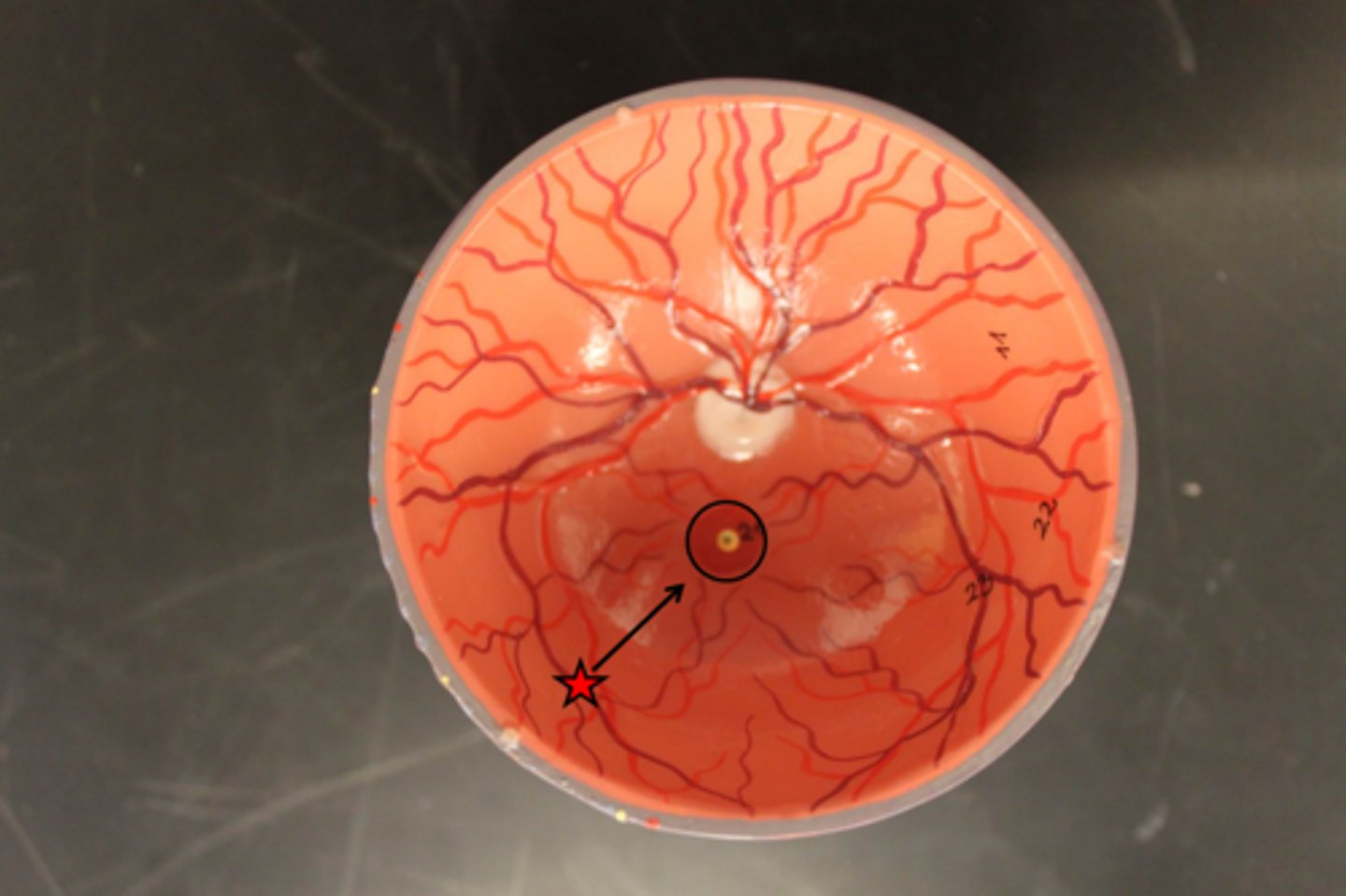 <p>Name this structure of the eyeball</p>