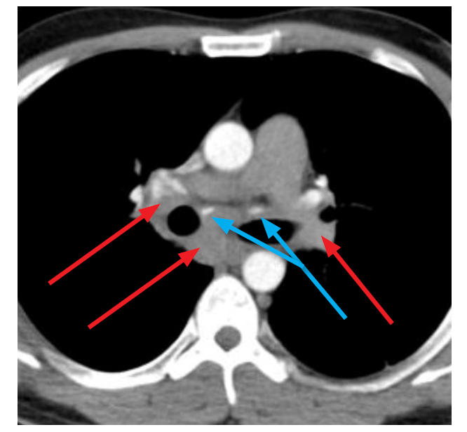 <p>What do you see? What condition would this be?</p>