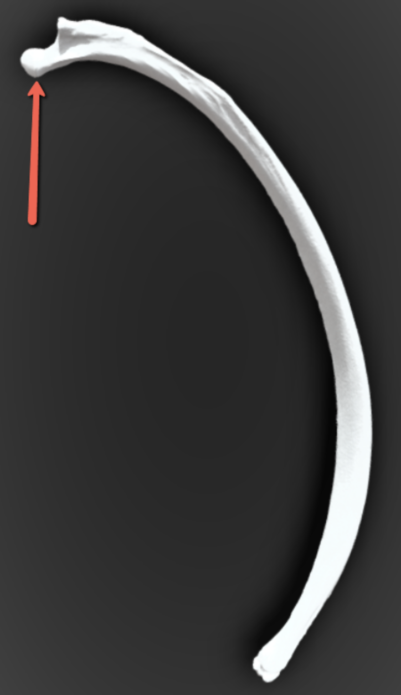 <p><span><strong>Identify the bone marking indicated by the pointer.</strong></span></p>
