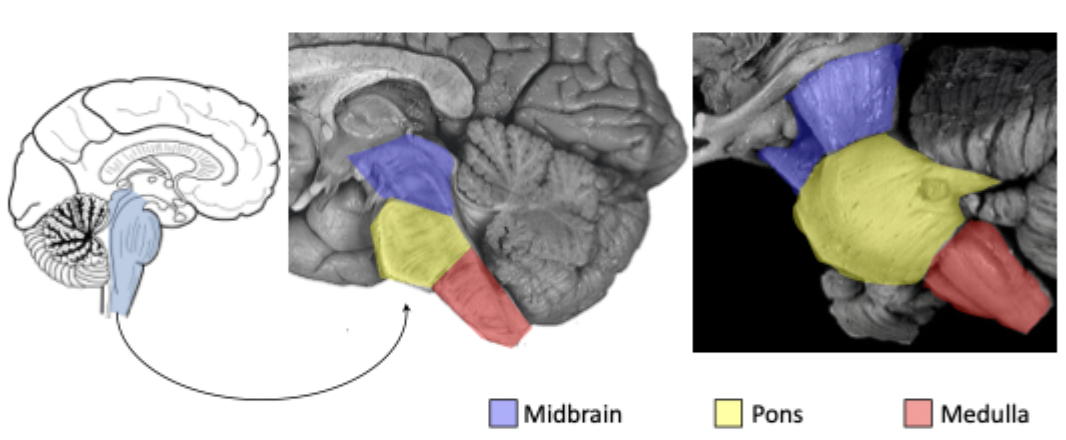 <p>Is located between the diencephalon (interbrain) and the spinal cord. Is composed of three major divisions:</p><ol><li><p>Midbrain (=mesencephalon)</p></li><li><p>Pons</p></li><li><p>Medulla oblongata (=myelencephalon = bulbus)</p></li></ol><p></p>