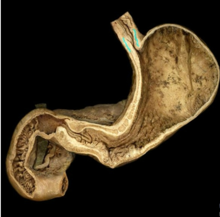 term image