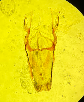 <p>ID this tongue-like organ, this is the opening to the</p>