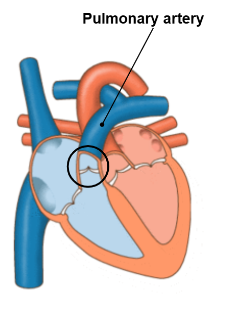 <p>pulmonary valve</p>