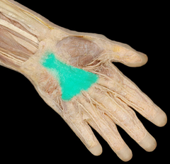 <p>palm</p>