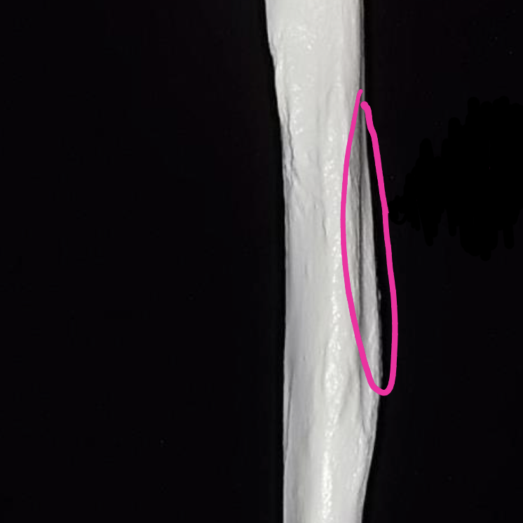 <p>Deltoid tuberosity (humerus shaft)</p>