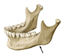 <p>Identify the structure</p>