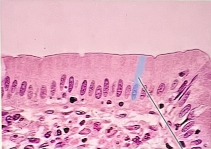 <p>identify the highlighted epithelium at the pointer</p>