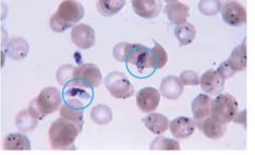 <p><span style="background-color: transparent; font-family: "Times New Roman", serif;">Plasmodium</span></p><img src="https://assets.knowt.com/user-attachments/c1f0153d-122d-49fd-a9ad-7e20c1e9cdd7.png" data-width="25%" data-align="center"><p></p>