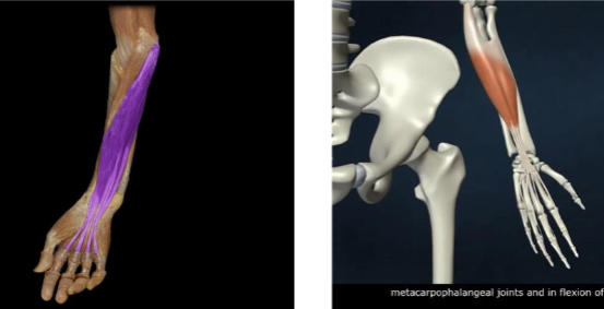 <p>wrist flexion, flexion of proximal interphalangeal joints (2-5)</p>