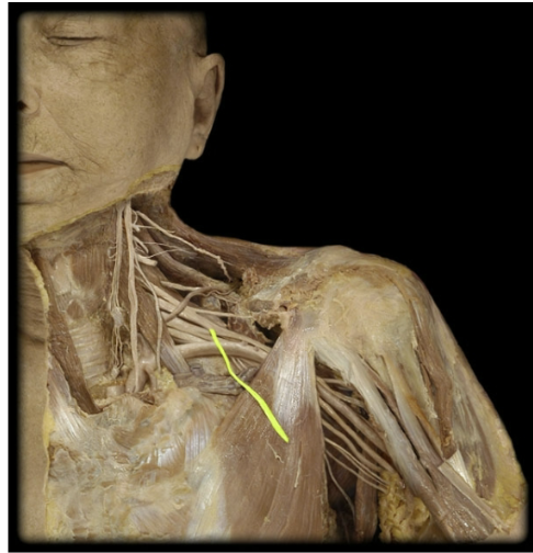 <p>What’s the spinal level of the lateral pectoral nerve?</p>