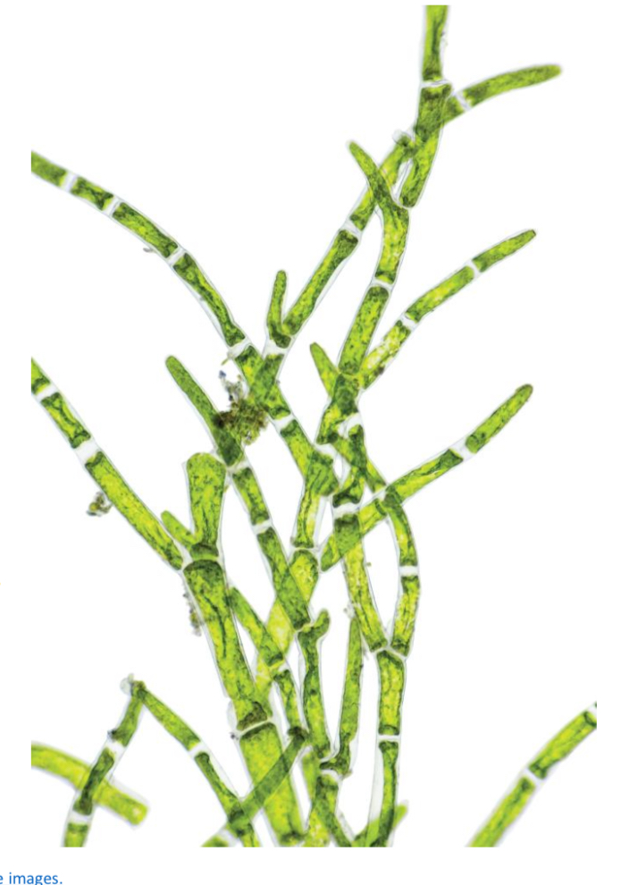 <p>What kind of colored algae is Xanthophyceae?</p>