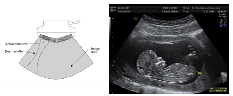 <ol><li><p>elements are arranges in a curve </p></li><li><p>fired in groups + electronically focused</p></li><li><p>used in abdominal and obstetrics</p></li></ol><p></p>