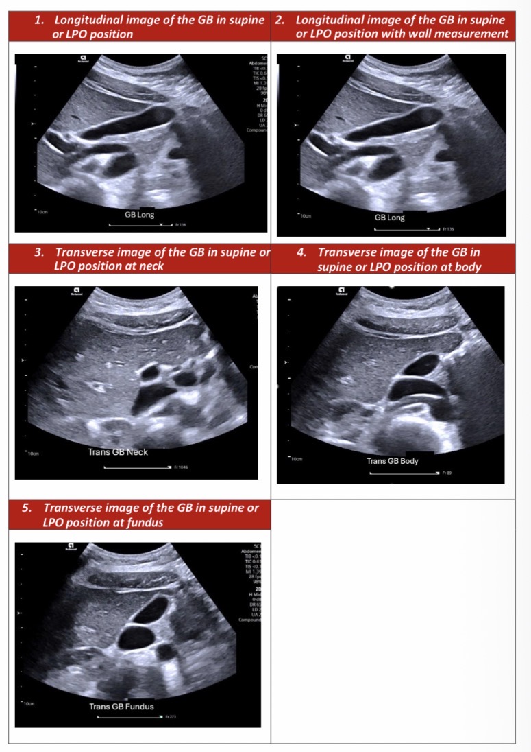 <p>Image for Gallbladder US</p>