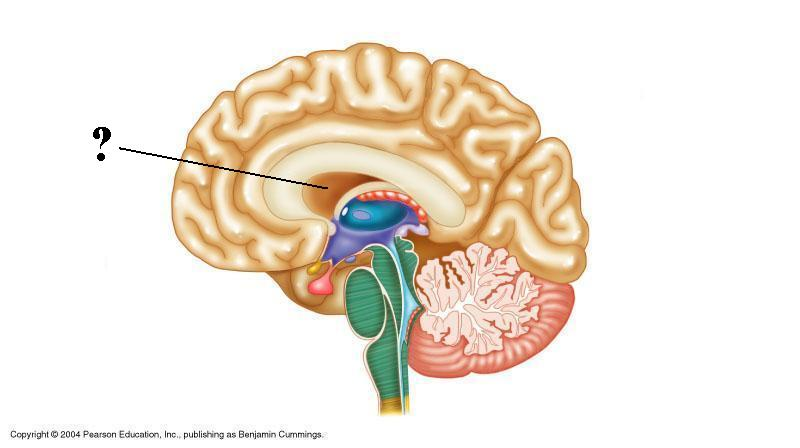 <p>Identify the indicated structure (membrane) of the brain</p>