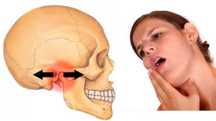 <p>DỄ BỊ hay bị, có xu hướng bị (tiêu cực) </p>