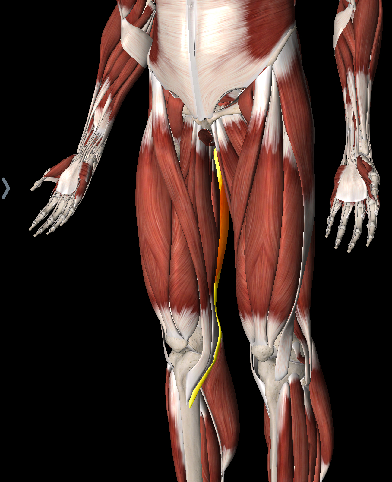 <p>What muscle is this?</p>