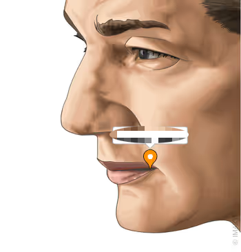 <p>the following picture is what extraoral structure?</p>