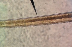 <p>band containing pores on ventral surface of esophageal region</p>