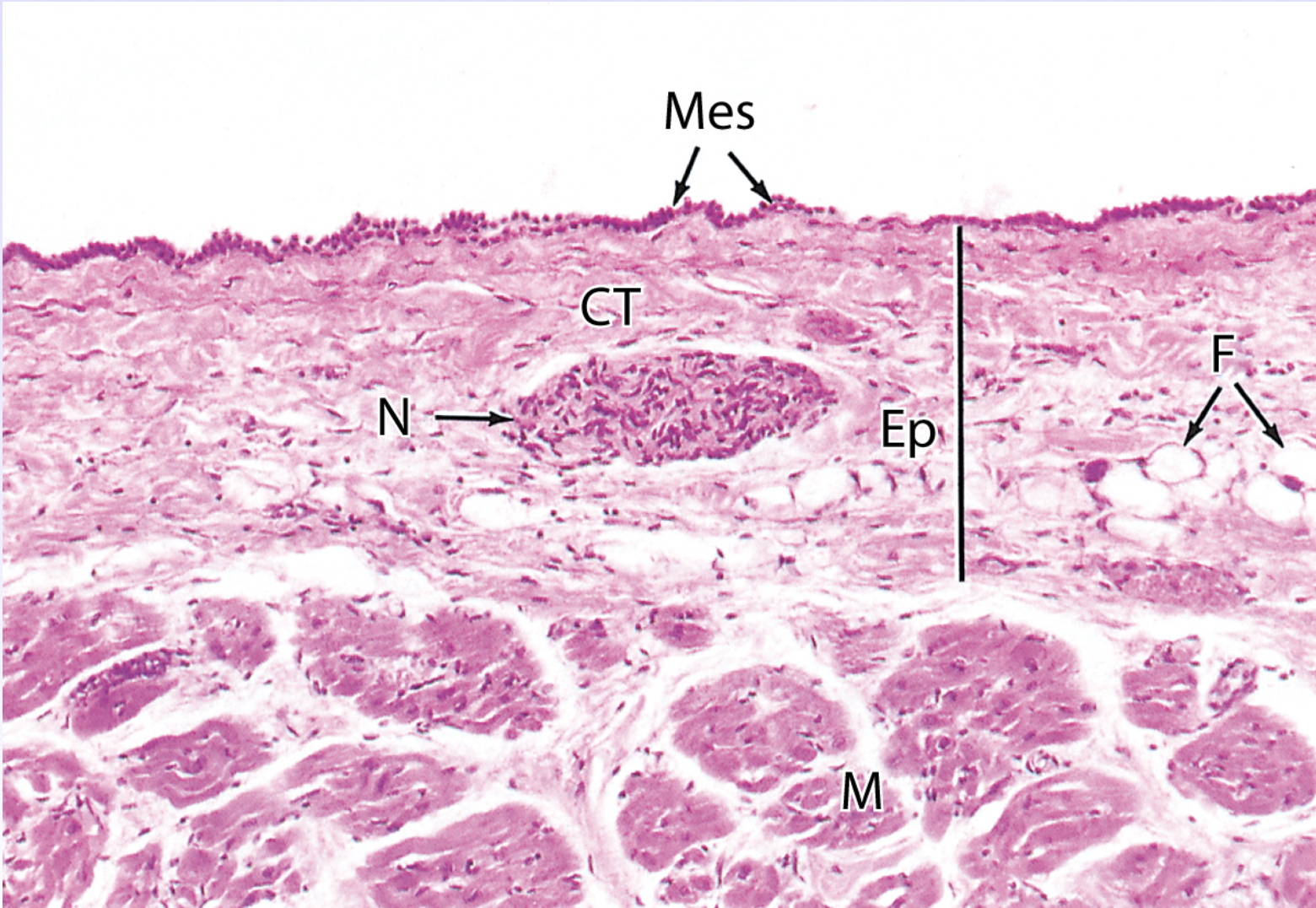 <p>Loose Connective Tissue (CT)</p>