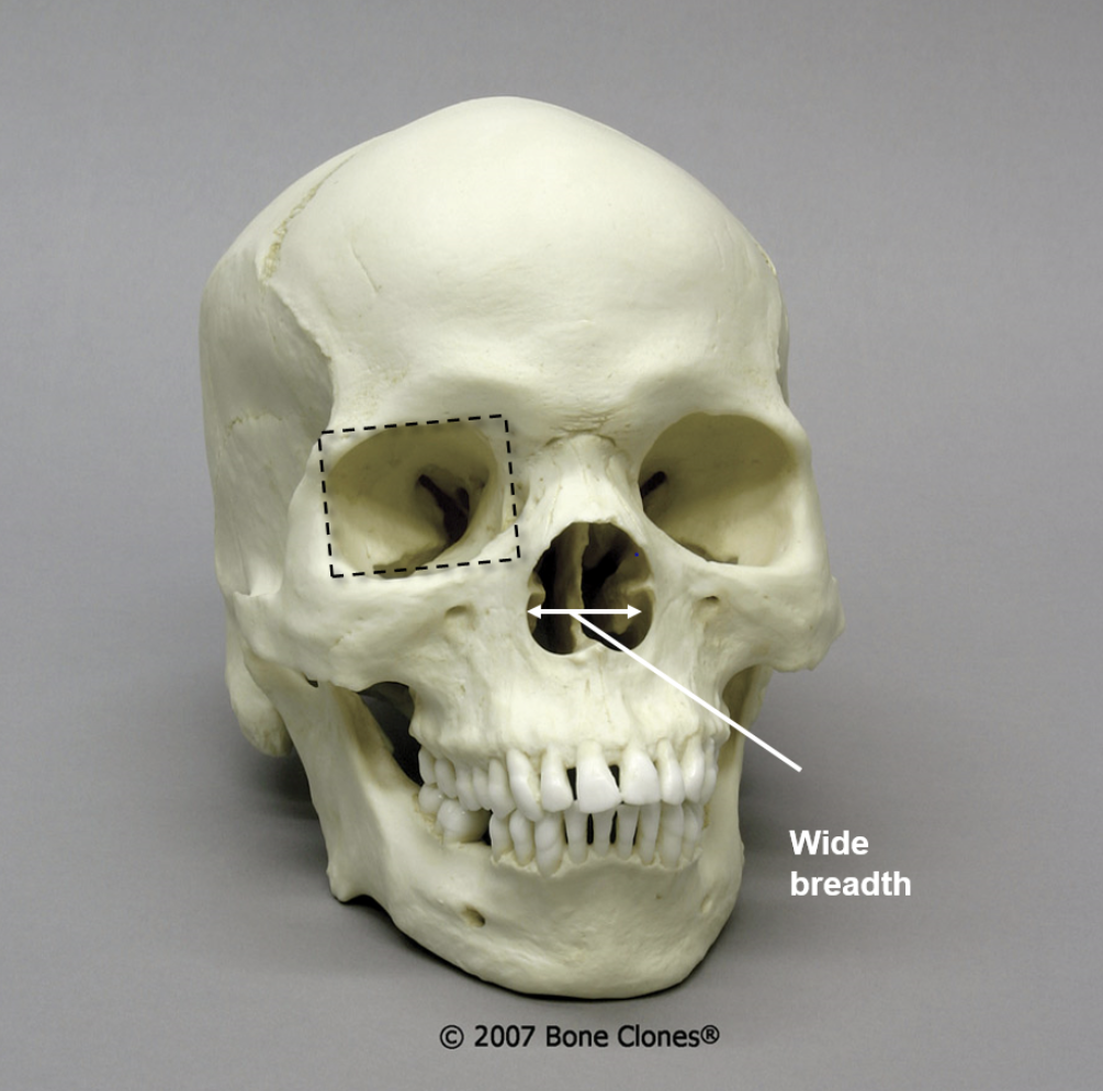 <p>what is the ancestry of this skull?</p>