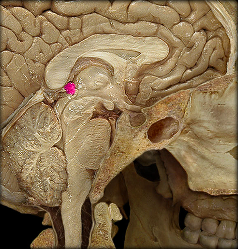 term image